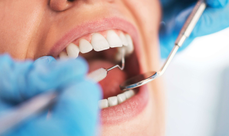 Periodoncia Clínica Vallegrande